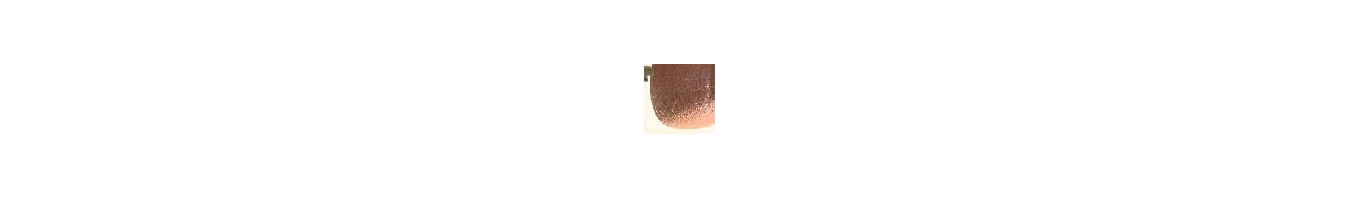 Dry-Cracked Skin-Moisturazing