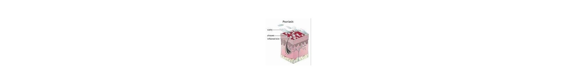 Psoriasis